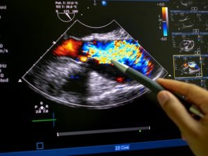 Echocardiography- Advanced Level/ Live Classes