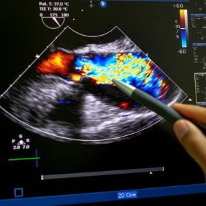 Echocardiography advanced level